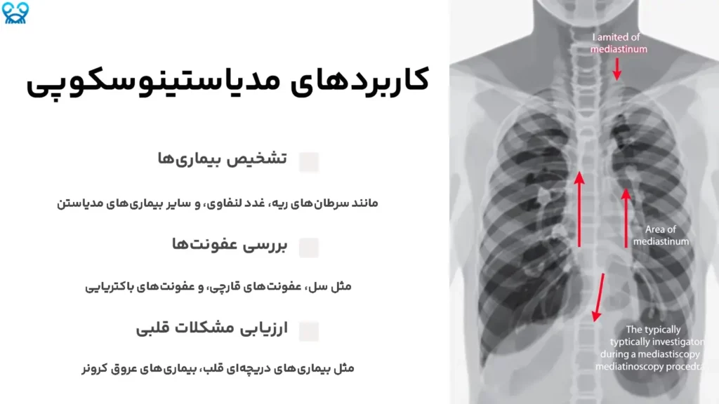 کاربردهای مدیاستینوسکوپی