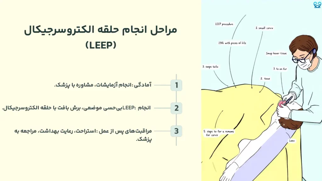 مراحل انجام حلقه الکتروسرجیکال (LEEP)