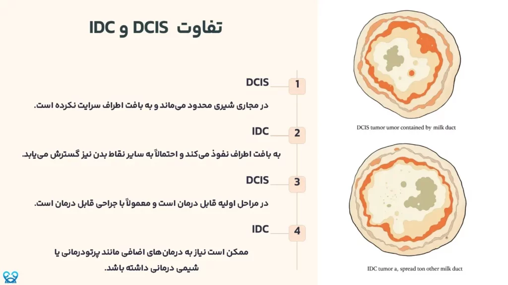  تفاوت DCIS  و IDC