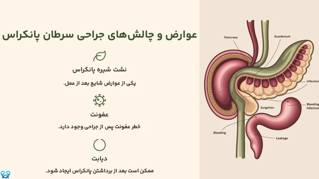عوارض و چالشهای جراحی سرطان پانکراس
