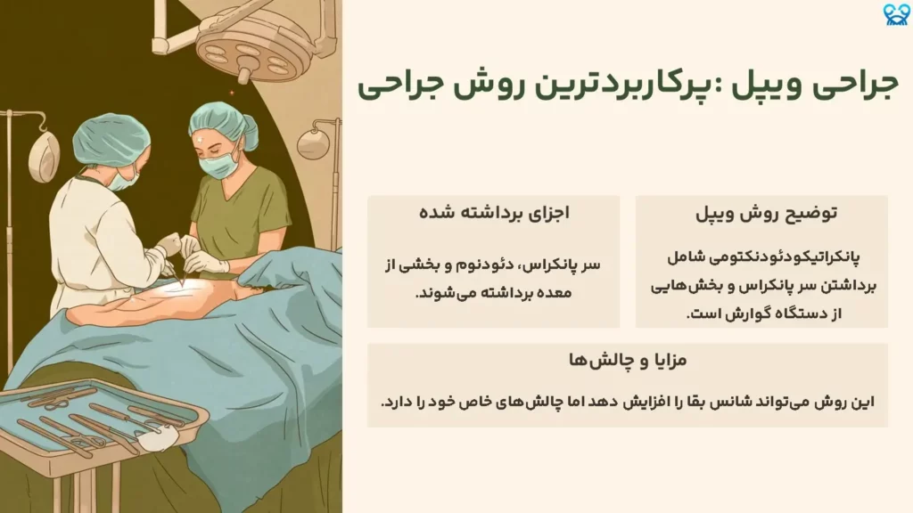 جراحی ویپل