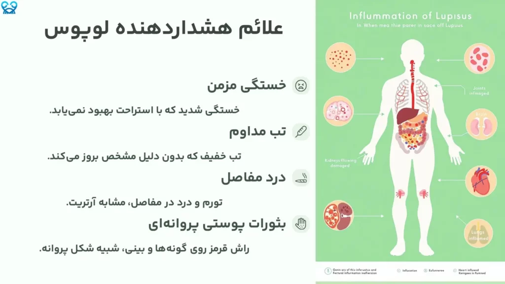 علائم هشداردهنده لوپوس