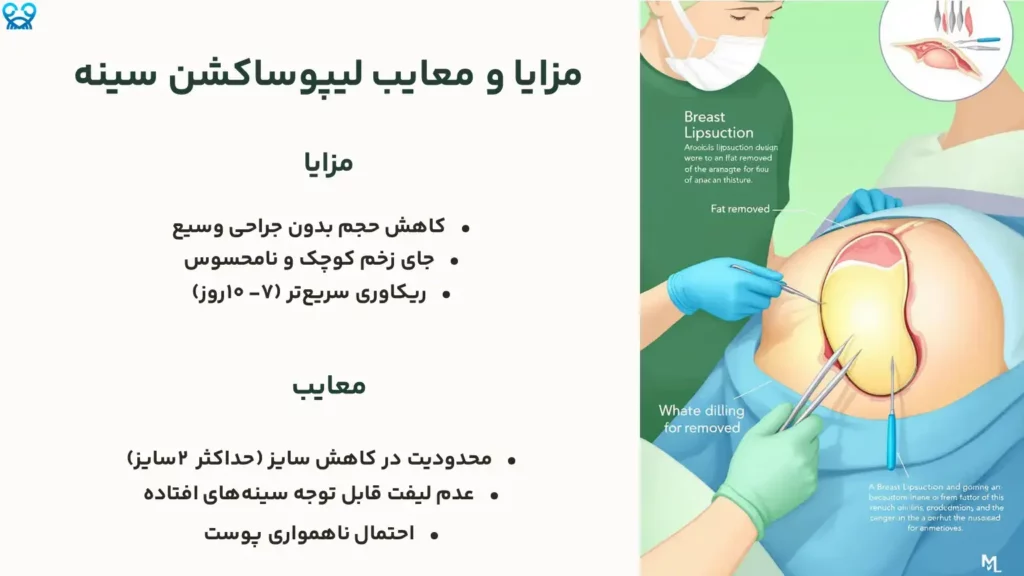 لیپوساکشن سینه