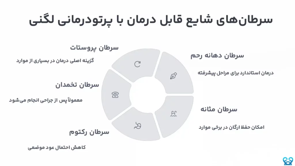 پرتو درمانی لگنی