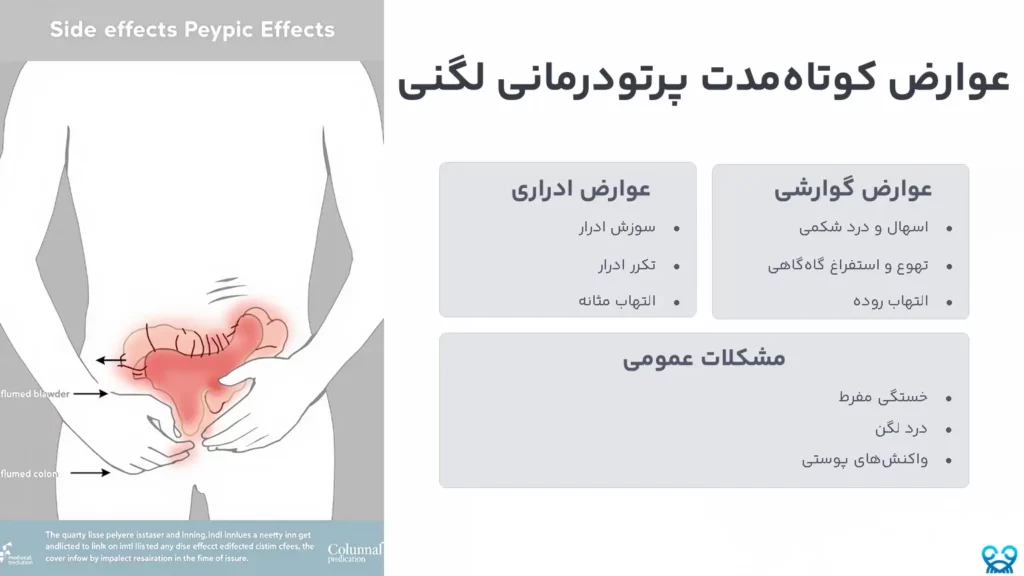 پرتو درمانی لگن