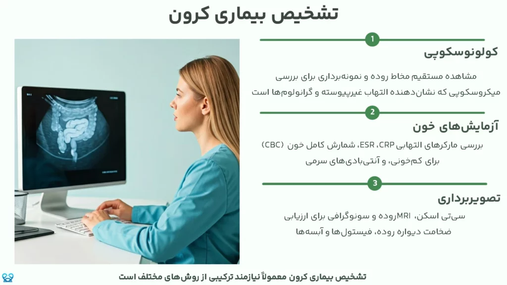 بیماری کرون