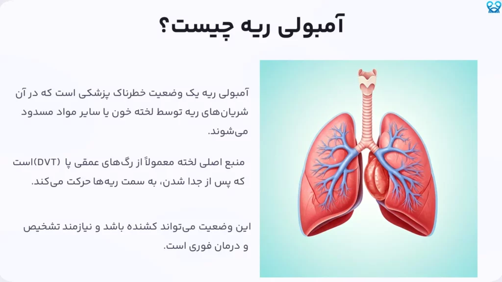 آمبولی و سرطان