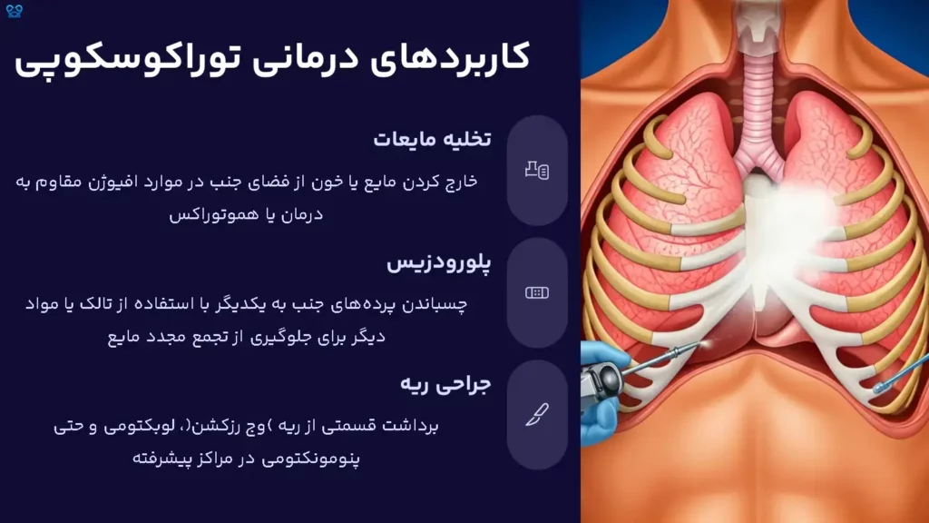 توراکوسکوپی