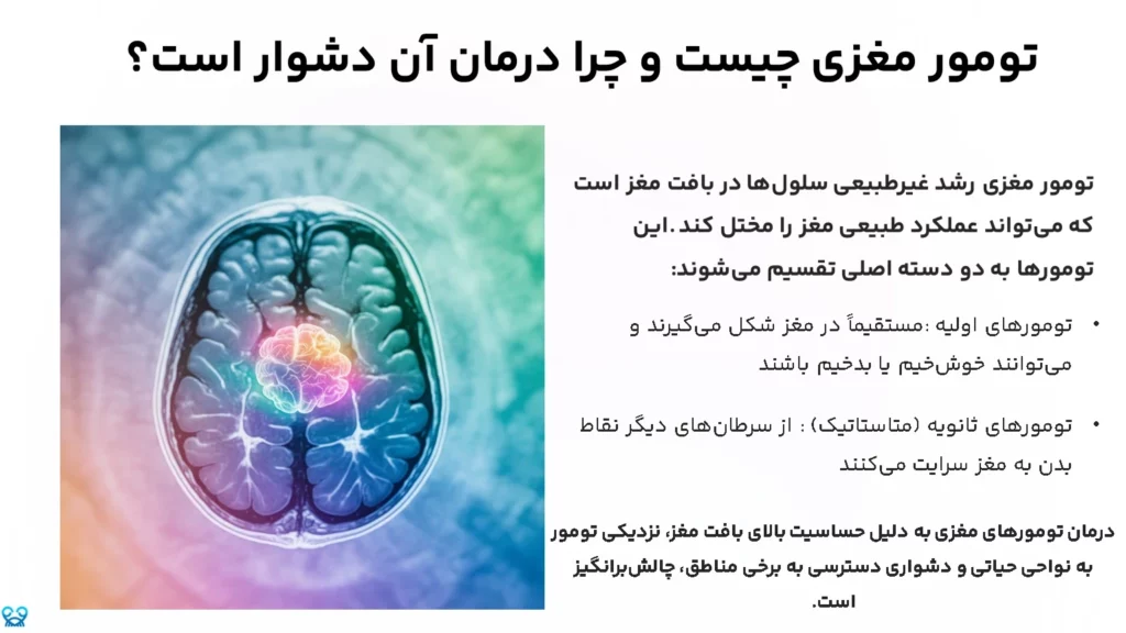 پرتودرمانی مغز