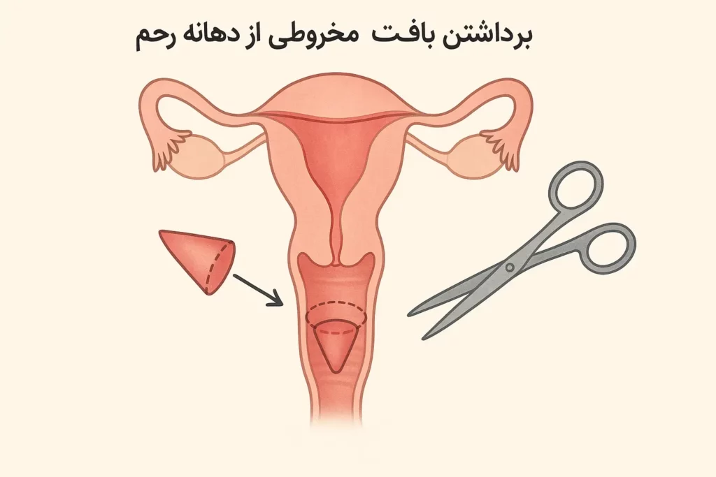 کونیزاسیون