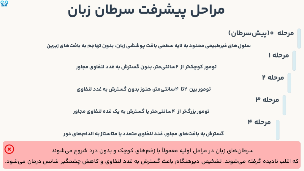 مراحل پیشرفت سرطان زبان