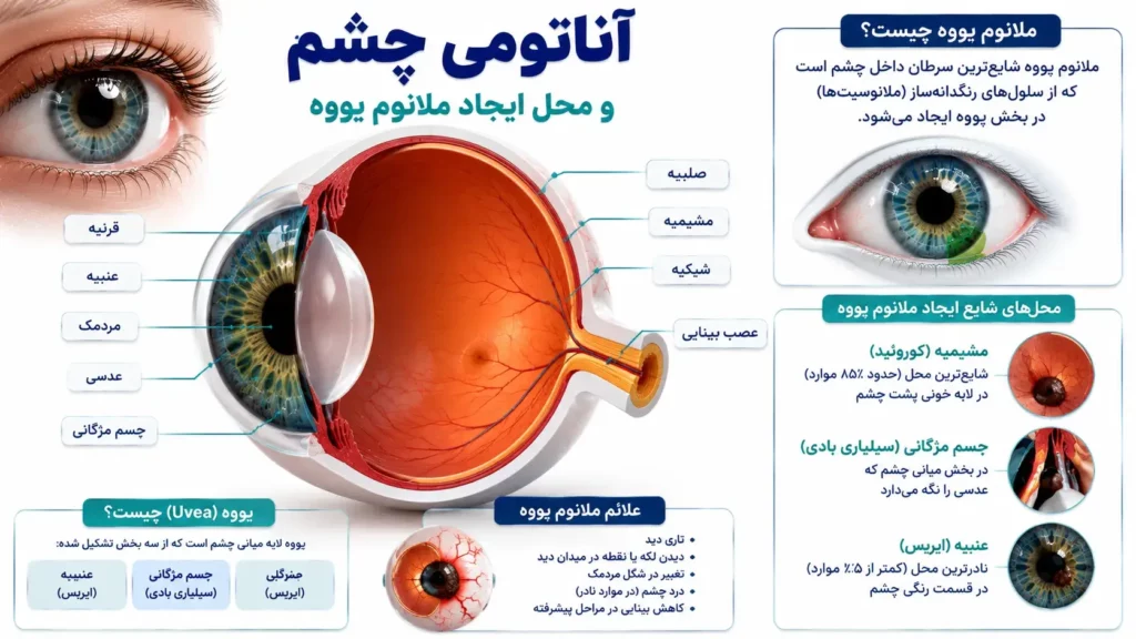 آناتومی چشم و محل ایجاد ملانوم یووه
