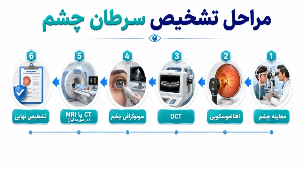 مراحل تشخیص سرطان چشم با OCT، سونوگرافی و MRI