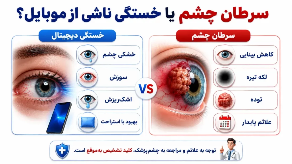 سرطان چشم