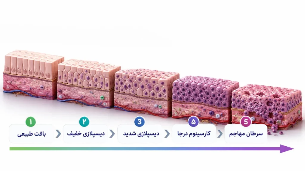 ضایعات پیش‌سرطانی
