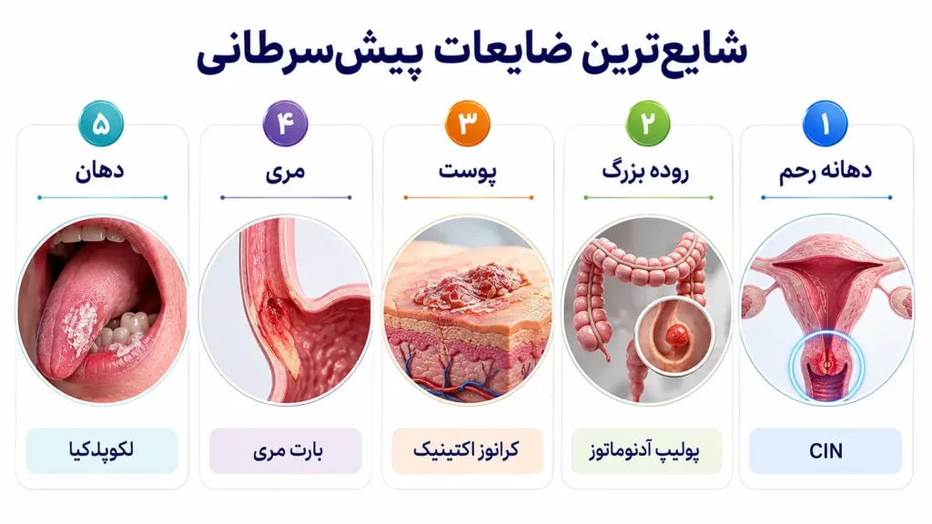 ضایعات پیش‌سرطانی