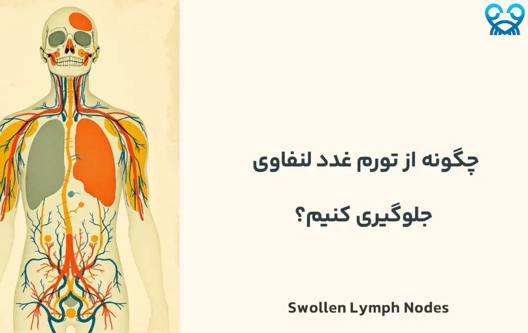 تورم غدد لنفاوی: چه زمانی باید نگران باشیم؟