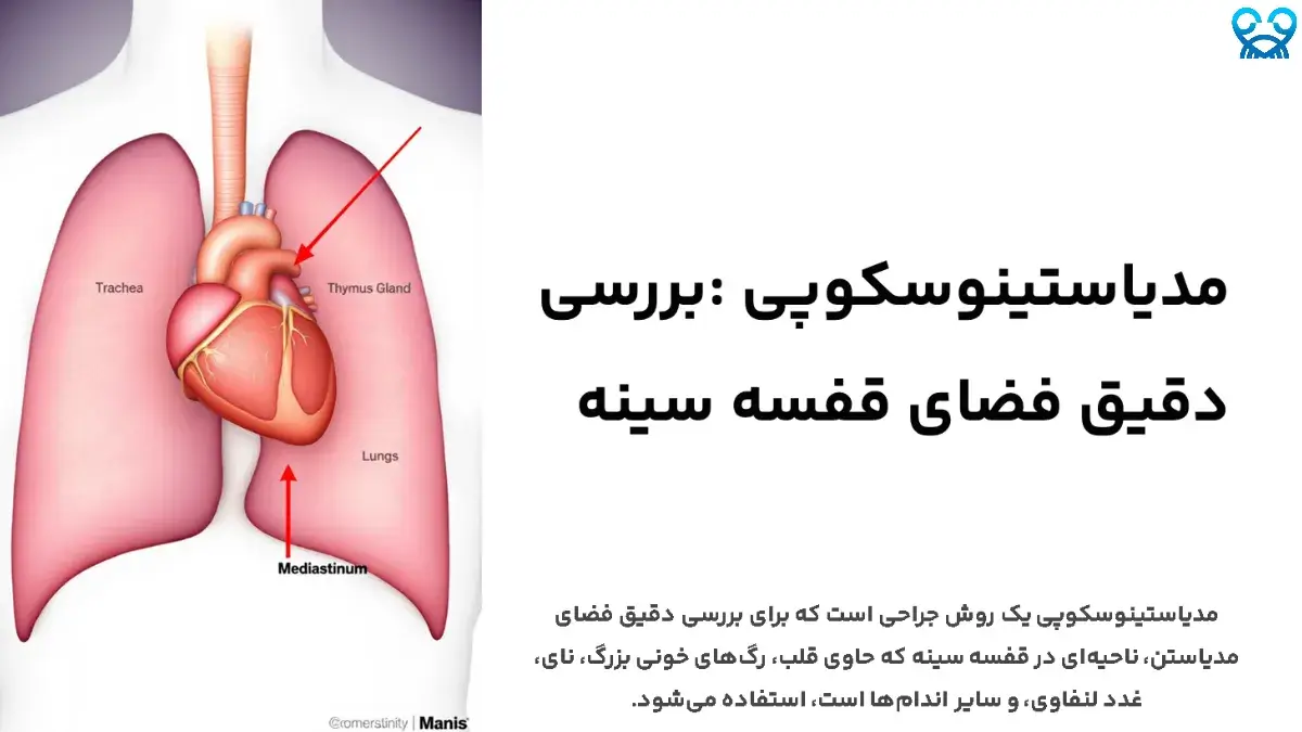 مدیاستینوسکوپی و نقش آن در تشخیص سرطان ریه