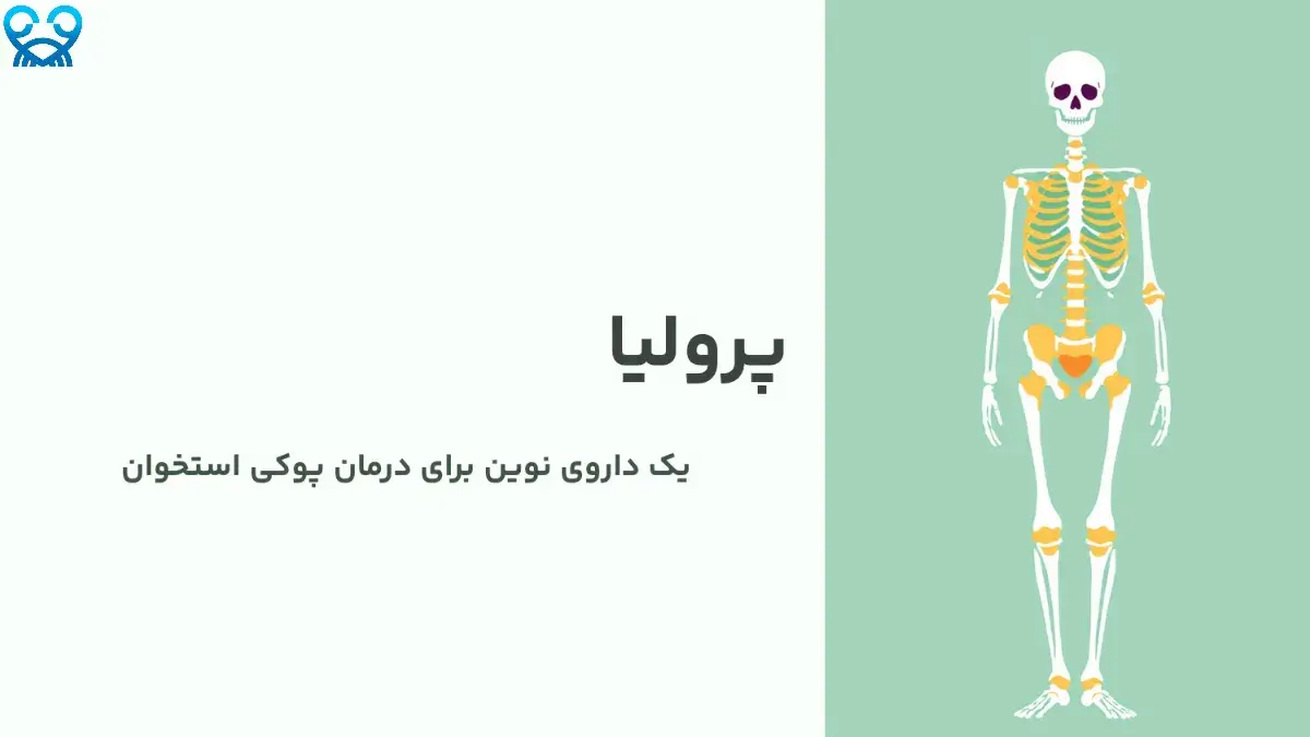 پرولیا: راهی نوین برای تقویت استخوان‌ها و جلوگیری از شکستگی