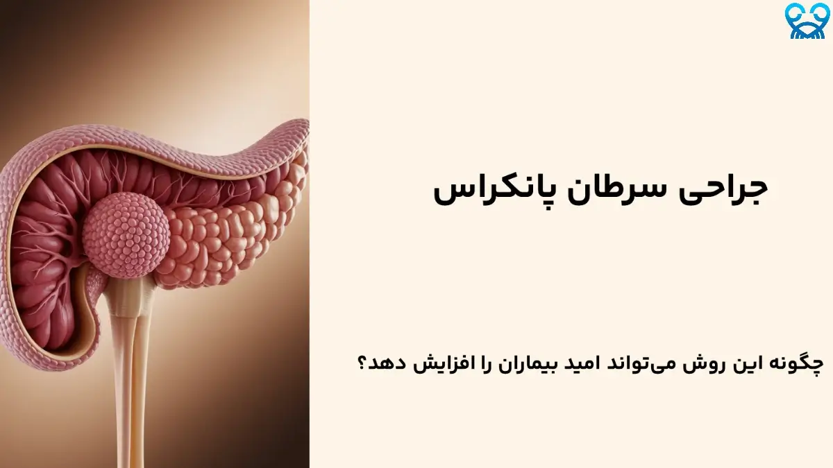 چه کسانی کاندید جراحی سرطان پانکراس هستند؟