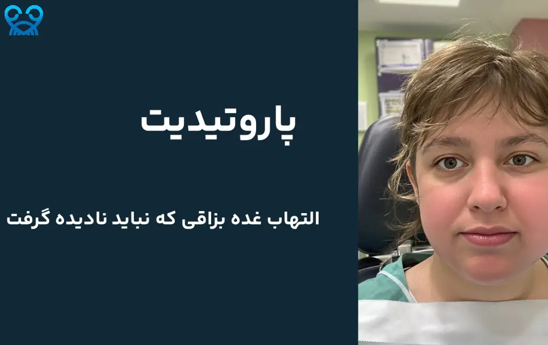 علائم پاروتیدیت 🤒 | از درد فک تا تب و خشکی دهانپاروتیدیت