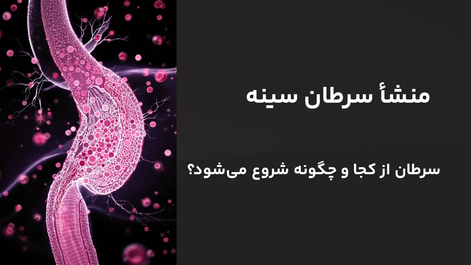 منشأ سرطان سینه | سرطان از کجا و چگونه شروع می‌شود؟