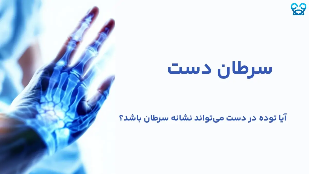 سرطان دست چقدر نادر و خطرناک است؟