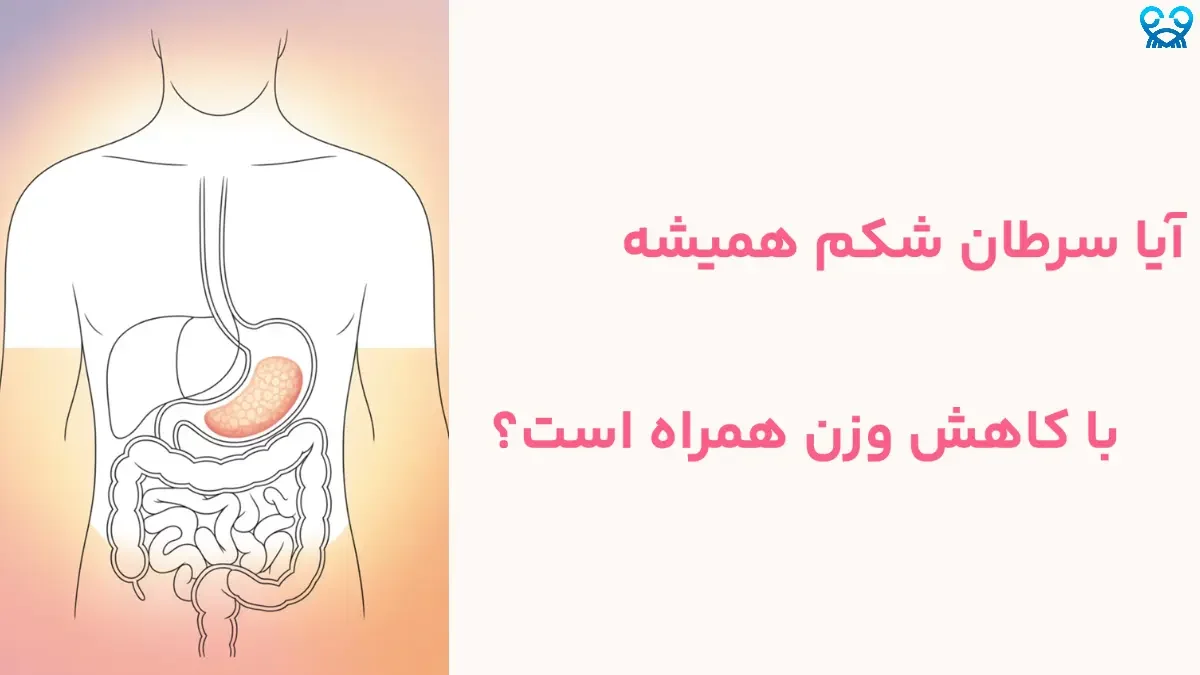 سرطان شکم؛ از تشخیص تا درمان و زندگی با آن