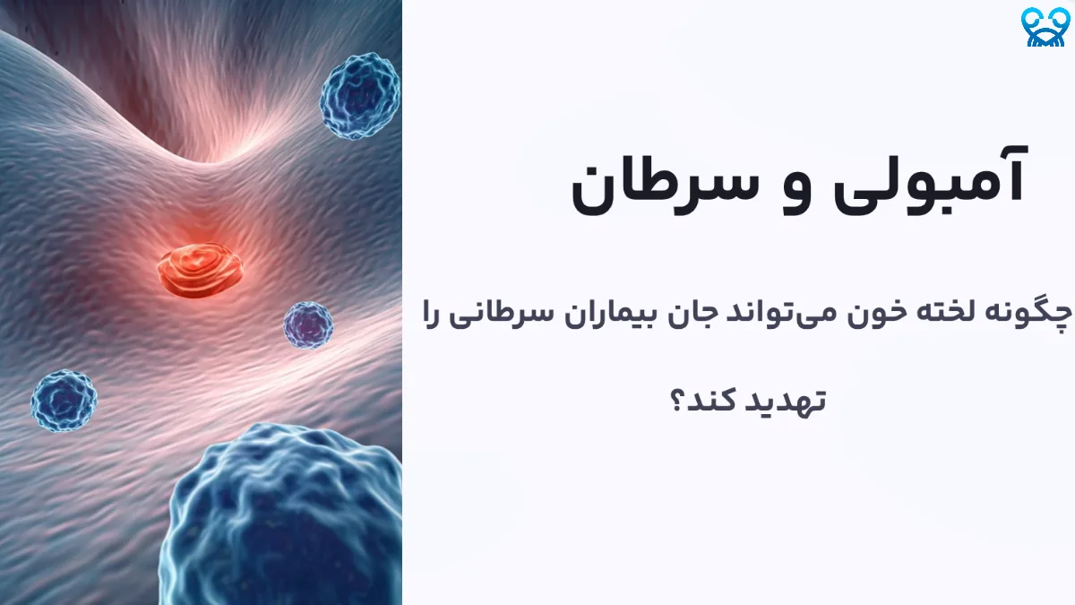 آمبولی و سرطان: خطر پنهانی که باید جدی گرفت