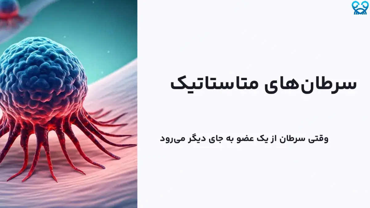 سرطان متاستاتیک چیست؟ درک عمیق از مرحله پیشرفته سرطان