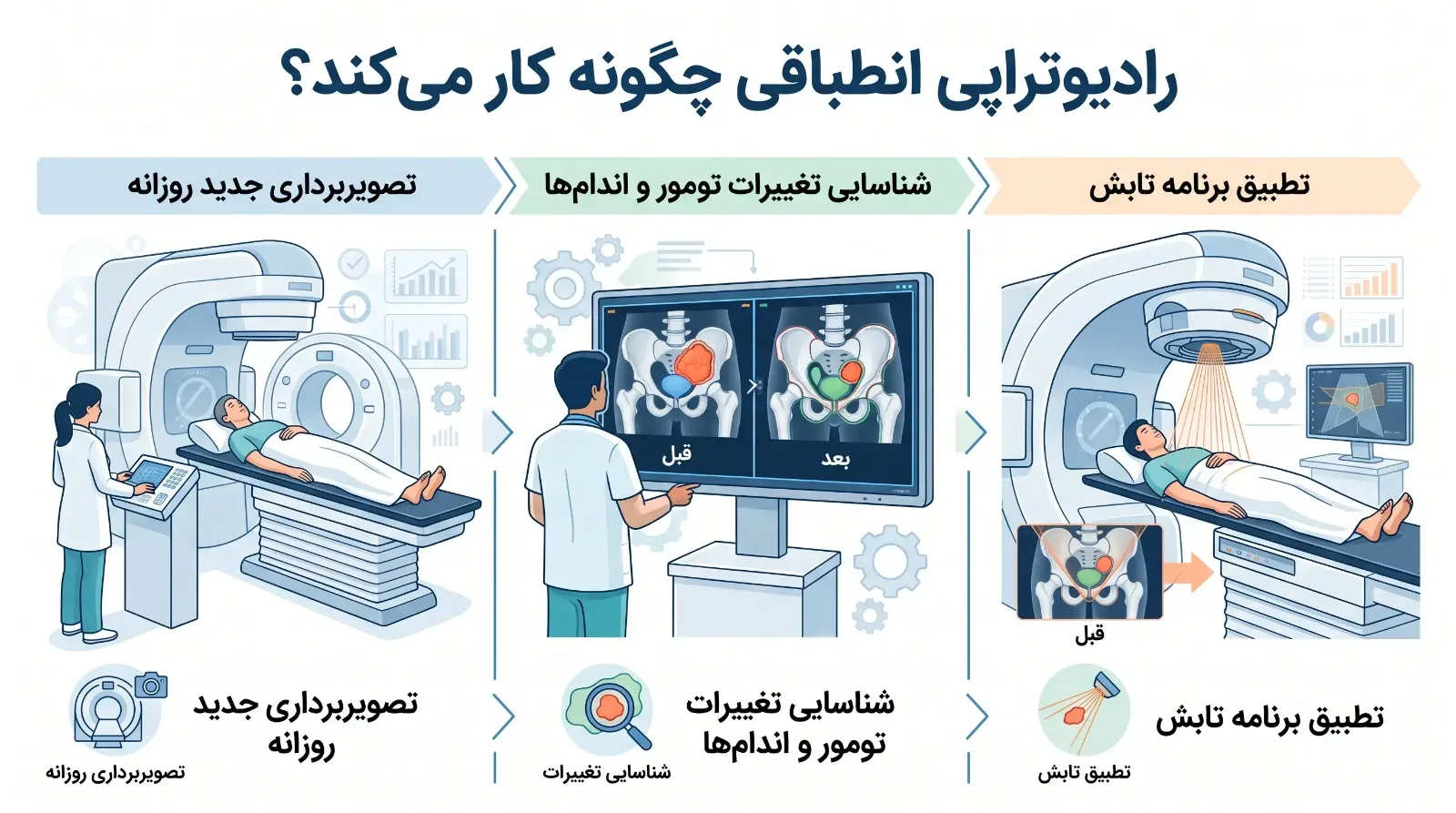رادیوتراپی انطباقی (ART)