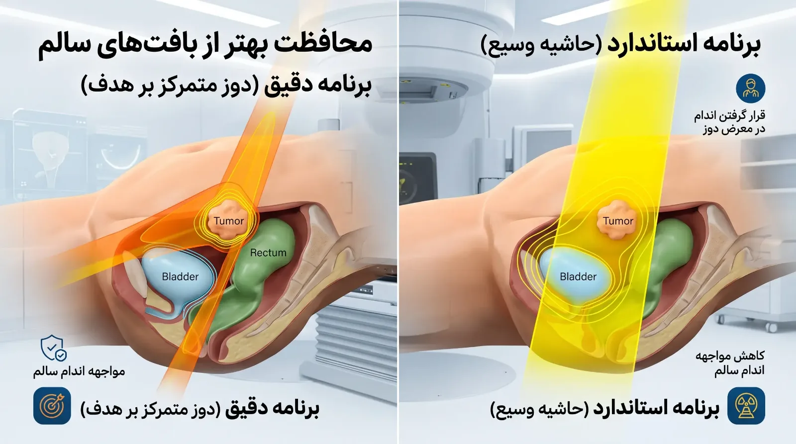 رادیوتراپی انطباقی (ART)