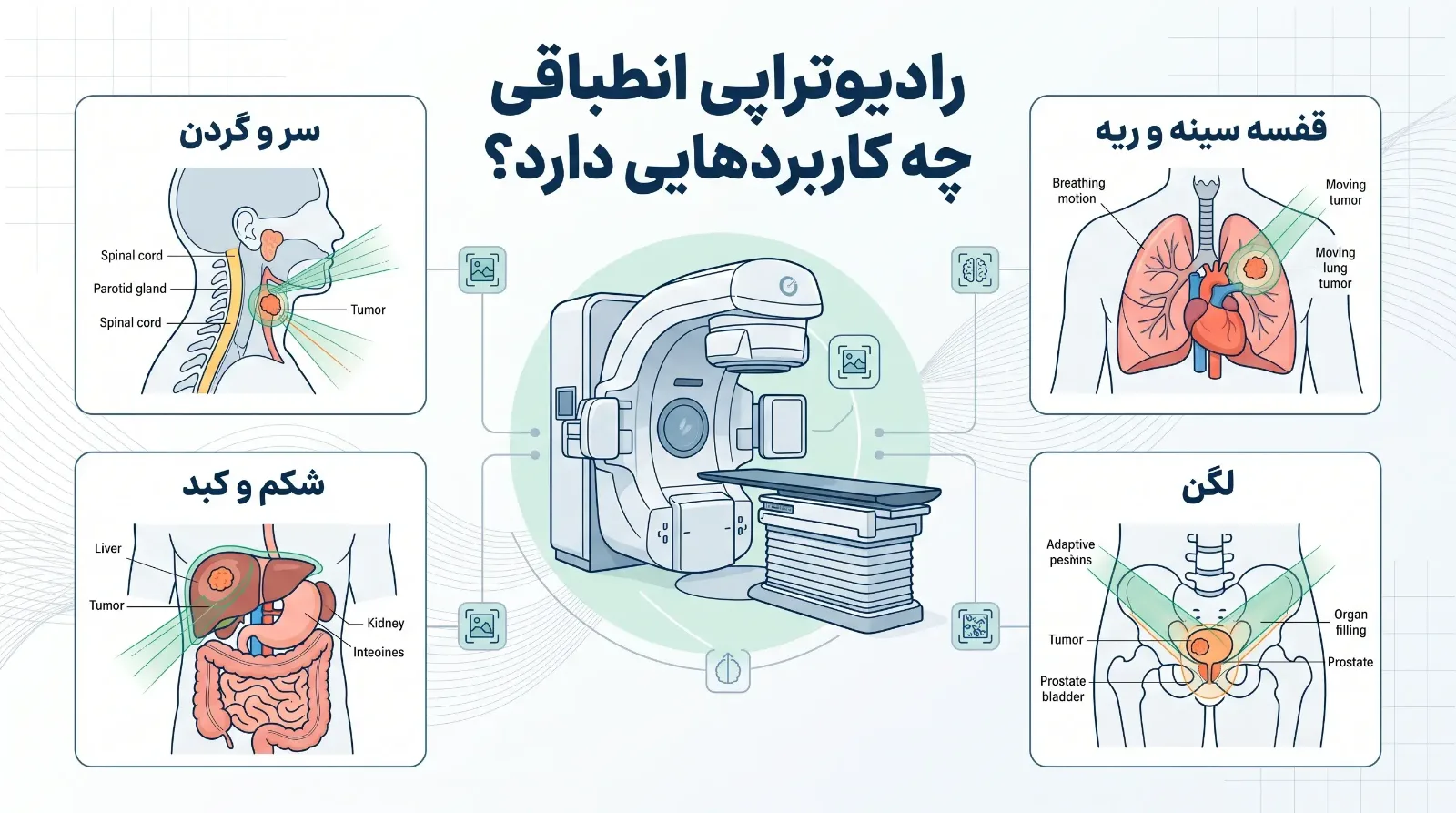 رادیوتراپی انطباقی (ART)