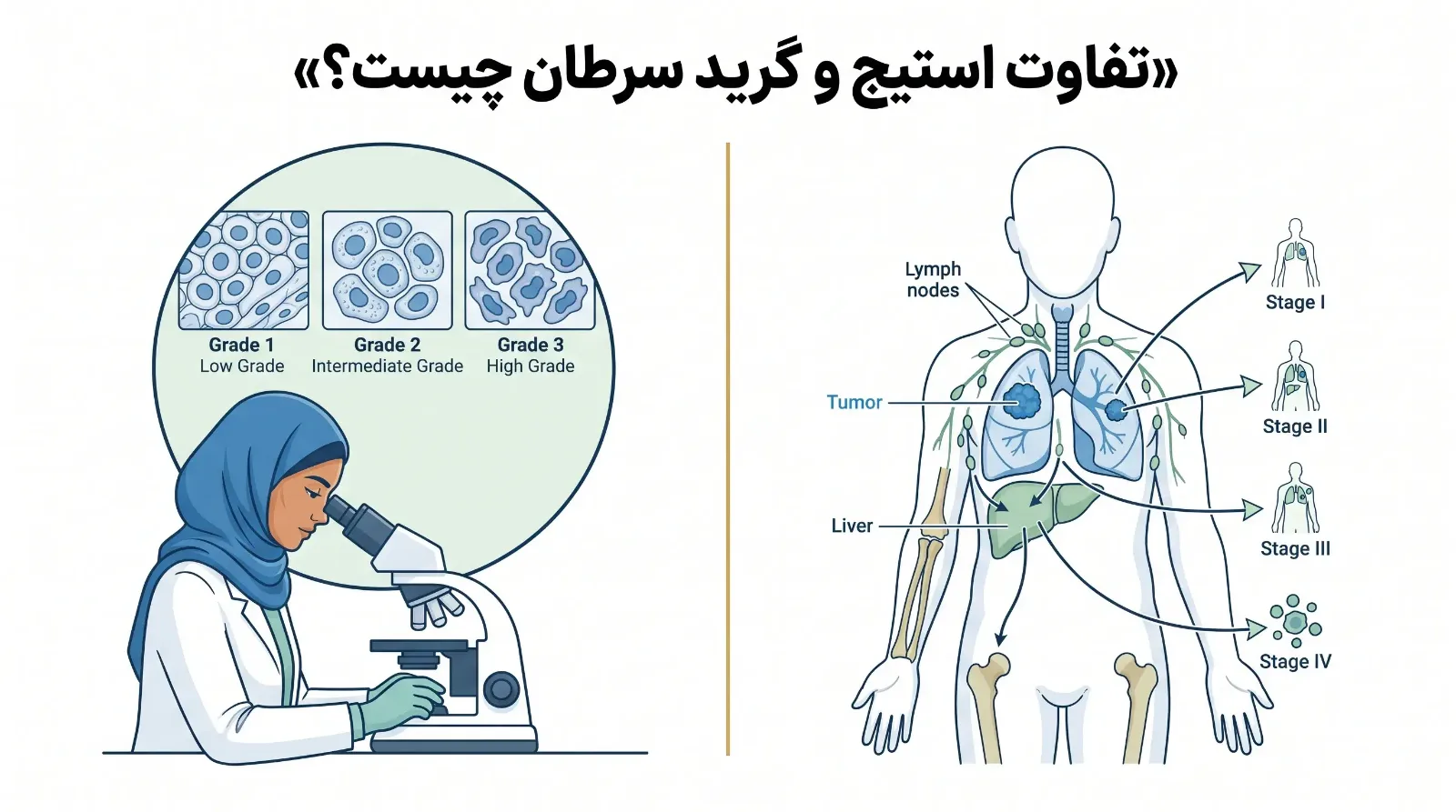 مراحل سرطان