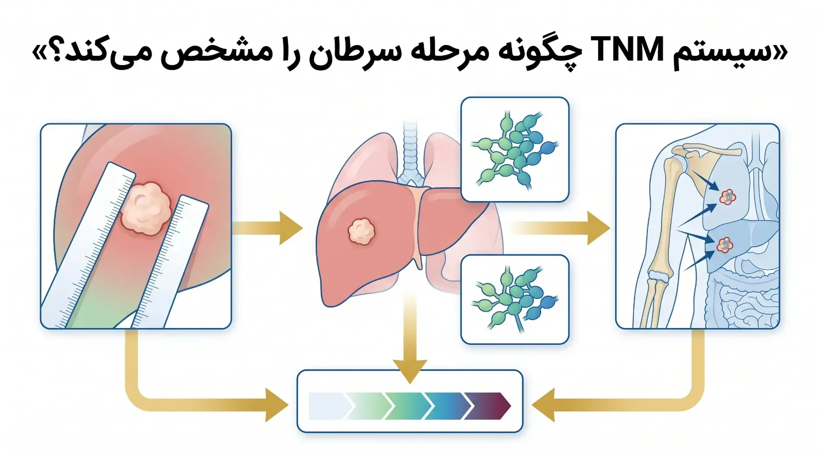 مراحل سرطان