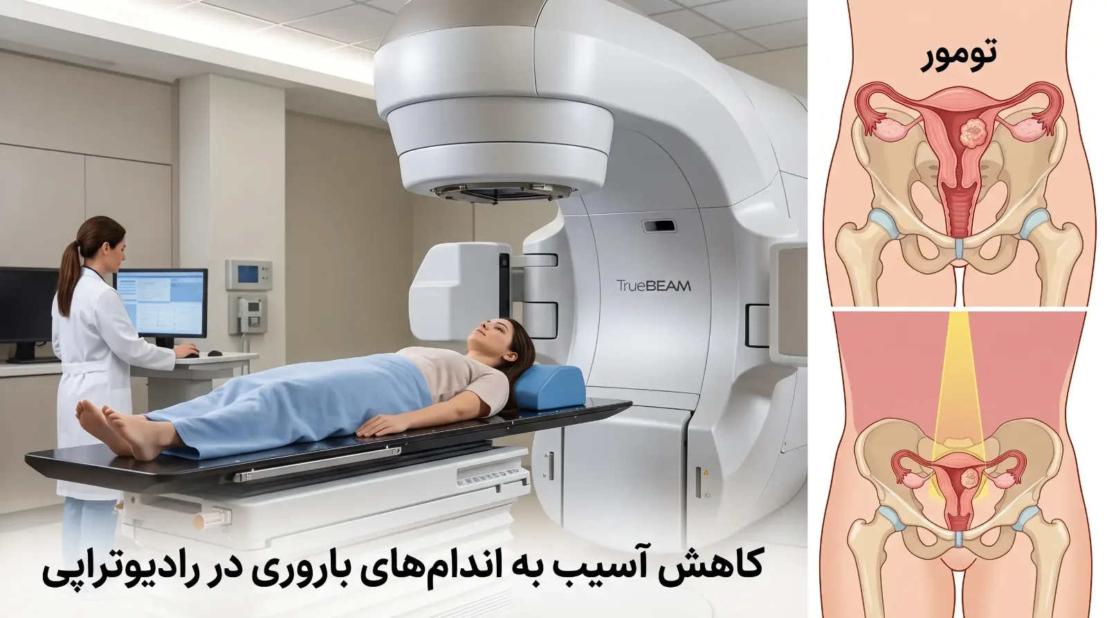 حفظ باروری در بیماران سرطان لگن