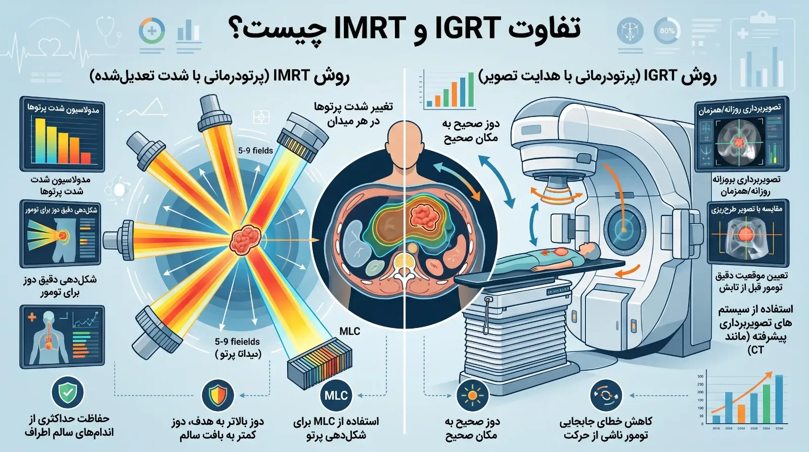 رادیوتراپی دقیق (IGRT)
