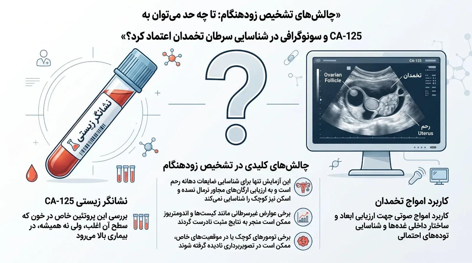 چرا تشخیص زودهنگام سرطان تخمدان دشوار است؟