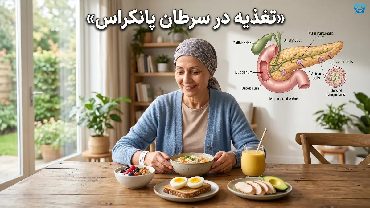 تغذیه در سرطان پانکراس