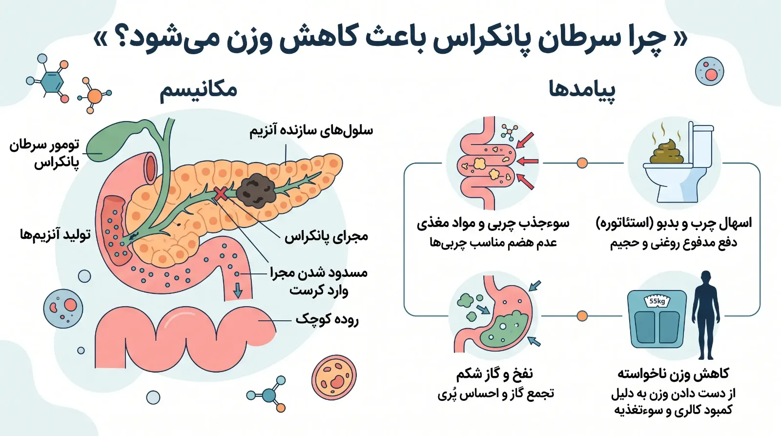 تغذیه در سرطان پانکراس