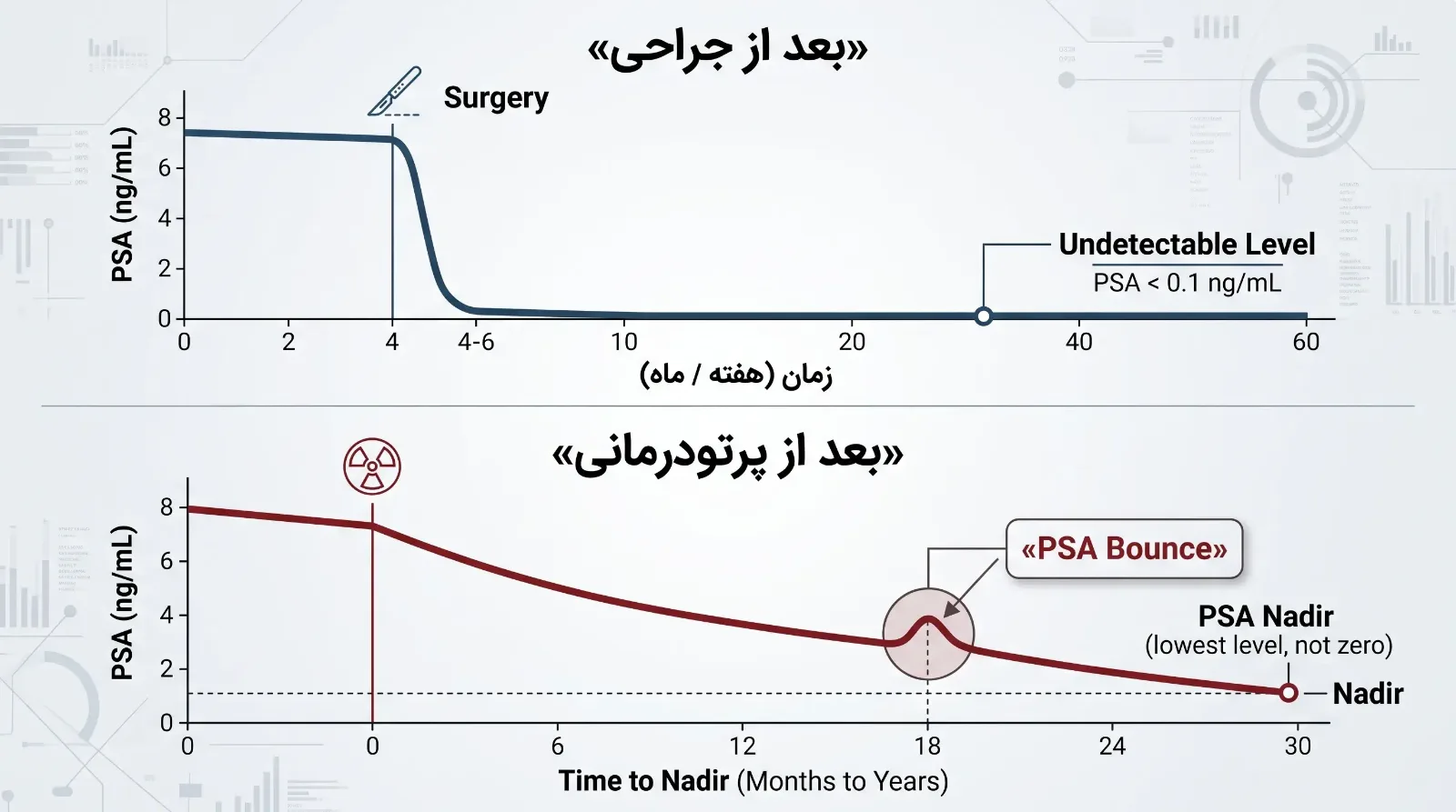 پرتودرمانی در سرطان پروستات