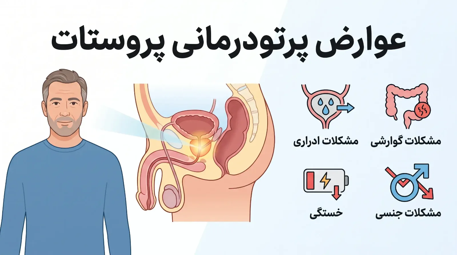 پرتودرمانی در سرطان پروستات